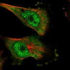 Immunofluorescent staining of human cell line U-251 MG shows localization to nucleoplasm & cytosol.