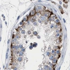 Immunohistochemical staining of human testis using Anti-HSD17B4 antibody HPA021302.