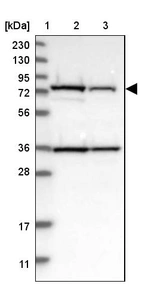 Lane 1: Marker [kDa] 230, 130, 95, 72, 56, 36, 28, 17, 11_br/_Lane 2: Human cell line RT-4_br/_Lane 3: Human cell line U-251MG sp