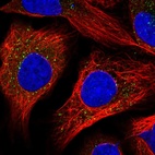 Immunofluorescent staining of human cell line U-2 OS shows localization to peroxisomes.