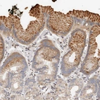 Immunohistochemical staining of human stomach shows strong cytoplasmic/cytoplasmic granular positivity in surface mucous cells.