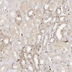 Immunohistochemical staining of human kidney shows moderate cytoplasmic positivity in cells in tubules.