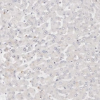 Immunohistochemical staining of human liver shows no positivity in hepatocytes as expected.