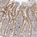 Immunohistochemical staining of human duodenum shows moderate membranous positivity in glandular cells.