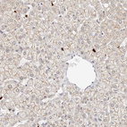 Immunohistochemical staining of human liver shows moderate membranous positivity in hepatocytes.