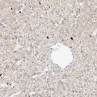 Immunohistochemical staining of human liver shows moderate membranous positivity in hepatocytes.
