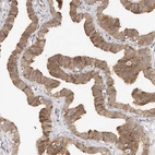 Immunohistochemical staining of human fallopian tube shows strong membranous positivity in glandular cells.