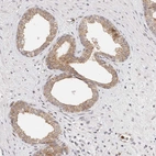 Immunohistochemical staining of human prostate shows moderate membranous positivity in glandular cells.