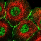 Immunofluorescent staining of human cell line A-431 shows localization to nucleoplasm, plasma membrane & cell junctions.