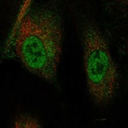 Immunofluorescent staining of human cell line HUVEC TERT2 shows localization to nucleoplasm.