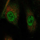 Immunofluorescent staining of human cell line HUVEC TERT2 shows localization to nucleoplasm.