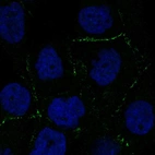 Anti-C2CD2L Antibody