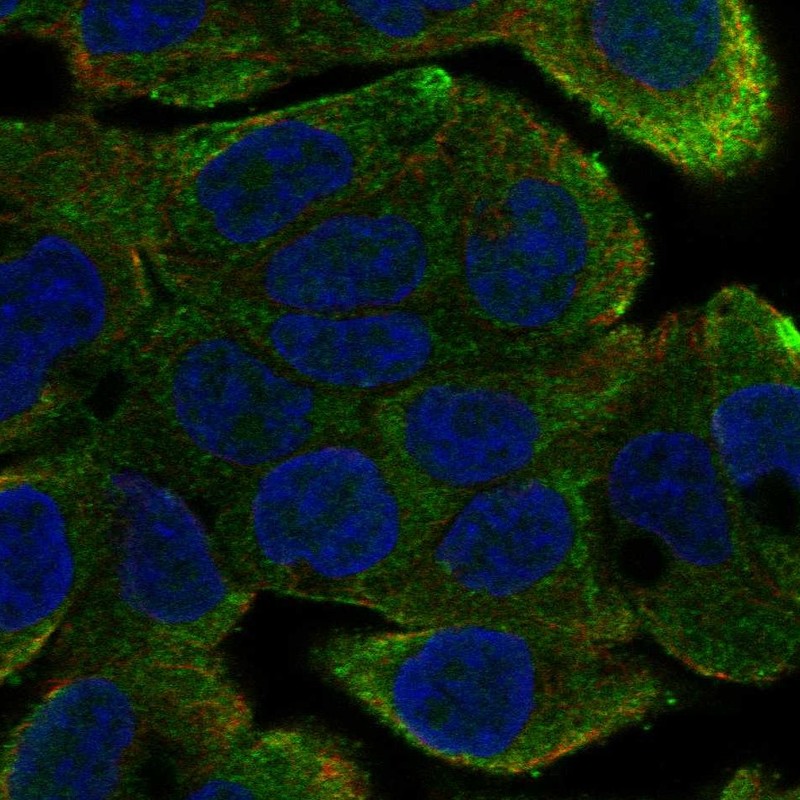 Anti-DNAAF4 Antibody