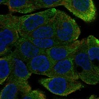 Anti-DNAAF4 Antibody
