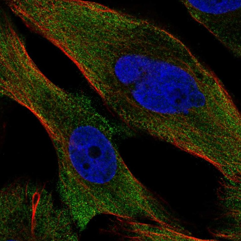 Anti-PPP3CC Antibody
