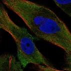 Anti-PPP3CC Antibody