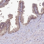 Immunohistochemical staining of human prostate shows moderate cytoplasmic-membranous positivity in glandular cells.