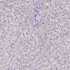 Immunohistochemical staining of human liver shows negative positivity in hepatocytes.