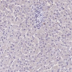 Immunohistochemical staining of human liver shows negative positivity in hepatocytes.