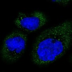 Immunofluorescent staining of human cell line A-431 shows localization to cytosol.