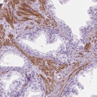 Immunohistochemical staining of human prostate shows strong cytoplasmic positivity in smooth muscle cells.