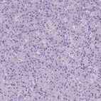 Immunohistochemical staining of human pancreas shows no positivity in exocrine glandular cells as expected.