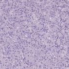 Immunohistochemical staining of human pancreas shows no positivity in exocrine glandular cells as expected.