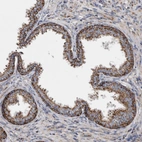 Immunohistochemical staining of human prostate shows strong cytoplasmic granular positivity in glandular cells.