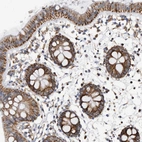 Immunohistochemical staining of human colon shows strong cytoplasmic positivity in glandular cells.