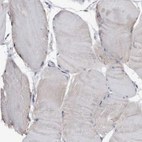 Immunohistochemical staining of human skeletal muscle shows no positivity in myocytes.