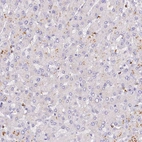 Immunohistochemical staining of human liver shows no positivity in hepatocytes as expected.
