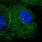 Immunofluorescent staining of human cell line A-431 shows positivity in plasma membrane & cytoplasm.