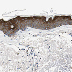 Immunohistochemical staining of human skin shows strong cytoplasmic positivity in squamous epithelial cells.