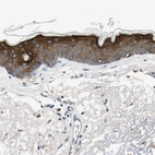 Immunohistochemical staining of human skin shows strong cytoplasmic positivity in squamous epithelial cells.