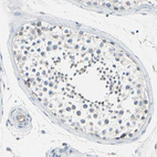 Immunohistochemical staining of human testis shows weak cytoplasmic positivity in cells in seminiferous ducts.