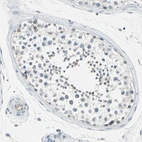 Immunohistochemical staining of human testis shows weak cytoplasmic positivity in cells in seminiferous ducts.