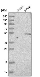 Western blot analysis in control (vector only transfected HEK293T lysate) and STK40 over-expression lysate (Co-expressed with a C-terminal myc-DDK tag (~3.1 kDa) in mammalian HEK293T cells, LY403137).