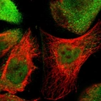 Immunofluorescent staining of human cell line A-431 shows localization to nucleoplasm & cytosol.
