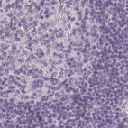 Immunohistochemical staining of human lymph node using Anti-HSD11B2 antibody HPA056385.