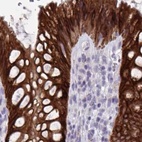 Immunohistochemical staining of human rectum using Anti-HSD11B2 antibody HPA056385.