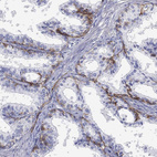 Immunohistochemical staining of human prostate shows strong membranous positivity in basal glandular cells.