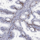 Immunohistochemical staining of human prostate shows strong membranous positivity in basal glandular cells.