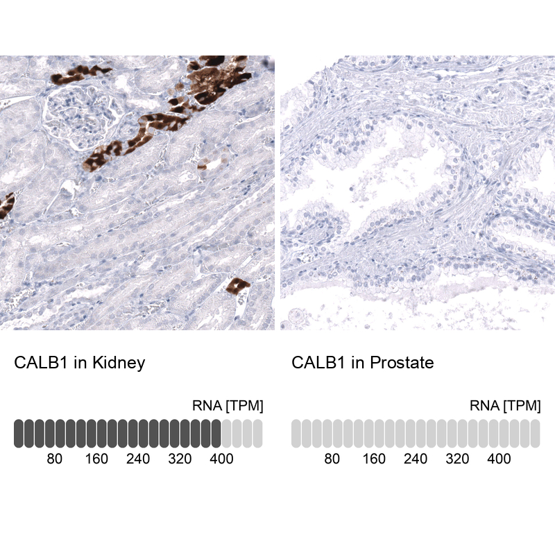 Anti-CALB1 Antibody