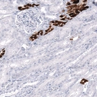 Immunohistochemical staining of human kidney shows strong cytoplasmic-membranous positivity in cells in tubules.