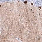 Immunohistochemical staining of human cerebellum shows strong cytoplasmic positivity in Purkinje cells.