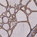 Immunohistochemical staining of human thyroid gland shows moderate to strong cytoplasmic positivity in glandular cells.