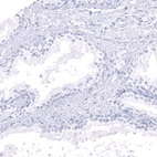 Immunohistochemical staining of human prostate shows no positivity in glandular cells as expected.