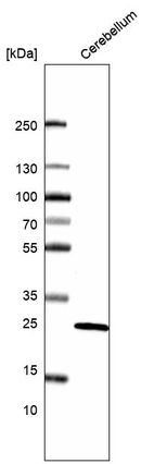 Western blot analysis in human cerebellum tissue.