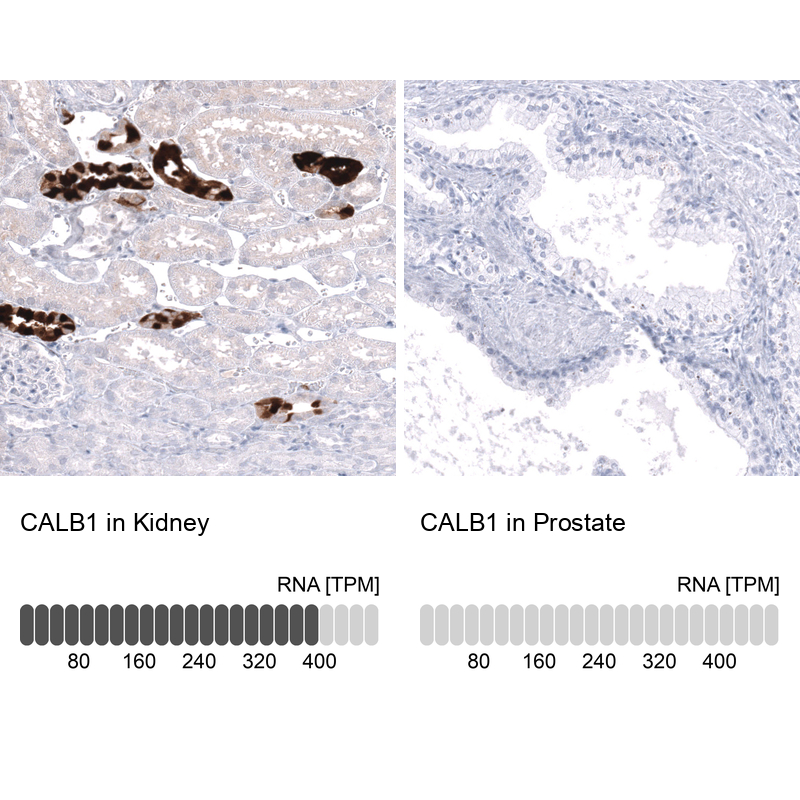 Anti-CALB1 Antibody
