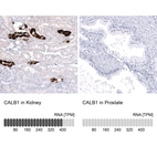 Anti-CALB1 Antibody